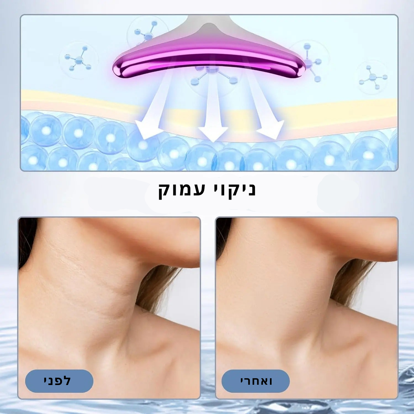 מכשיר להרמת פנים וצוואר
